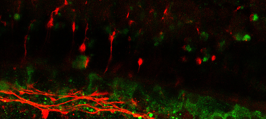 image of stained neurons