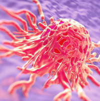 Cervical cancer cell