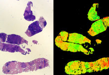 ‘Digistain’ technology offers revolution in detailed cancer diagnosis