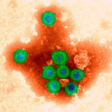 Rotavirus, electron micrograph - coloured
