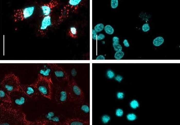 Cancer cells (blue) are deactivated