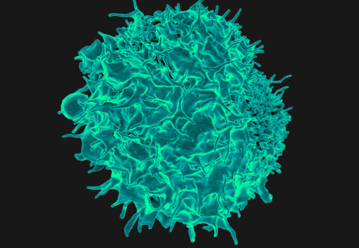 The virus attacks T-cells (illustrated), affecting large numbers of genes, which can lead to leukaemia