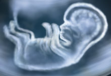 New technology can keep an eye on babies' movements in the womb