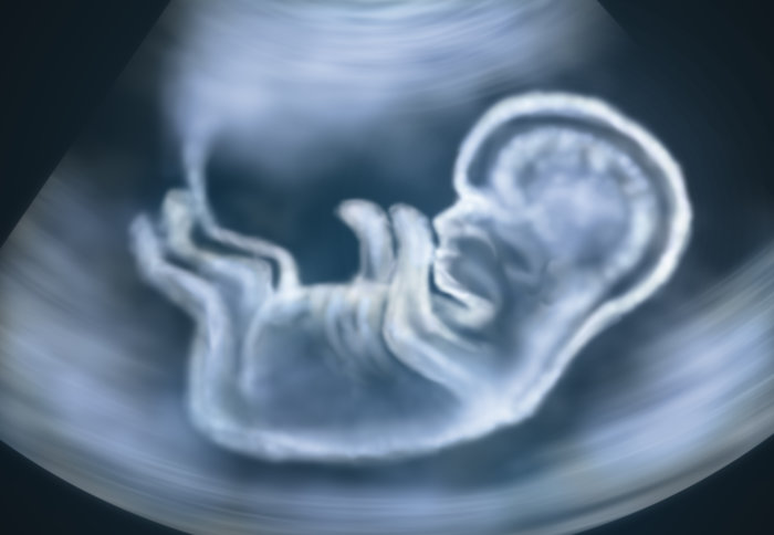 Ultrasound image of baby in mother's womb