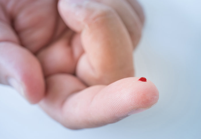 A hand with a drop of blood at the end of the first finger