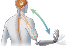 Imperial academics win €10m ERC grant to give bionic limbs sense of touch