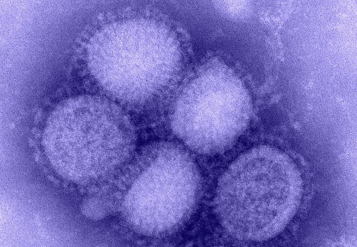 H1N1 influenza virus