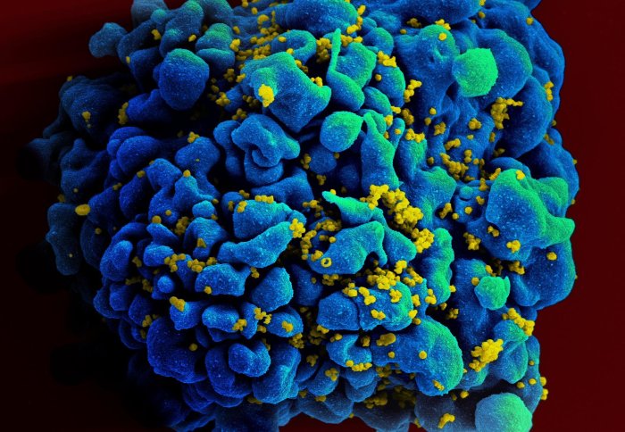 HIV-infected immune cell