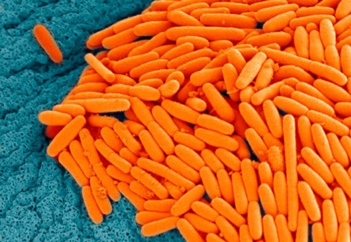 Rod-shaped C. diff bacteria highly magnified. The orange, rod-shaped cells