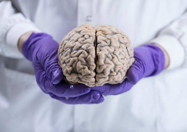 A brain specimen from Imperial's brain bank