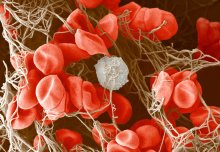 Enzyme’s ‘molecular scissors’ cut out fatal blood clot risk when injury strikes
