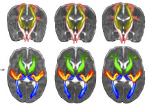 Baby brain scan library could help push forward research