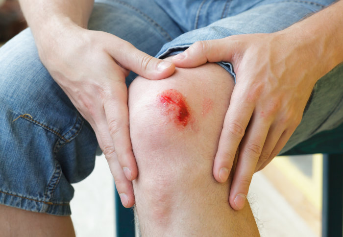 grazed knee