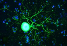 Epigenomic “map” helps predict nerve cells’ ability to regenerate after injury