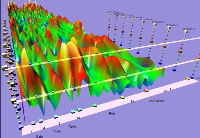 Brain activity rendered as a series of peaks and troughs