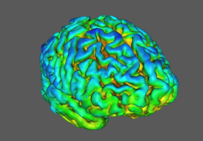 brain scan schizophrenia