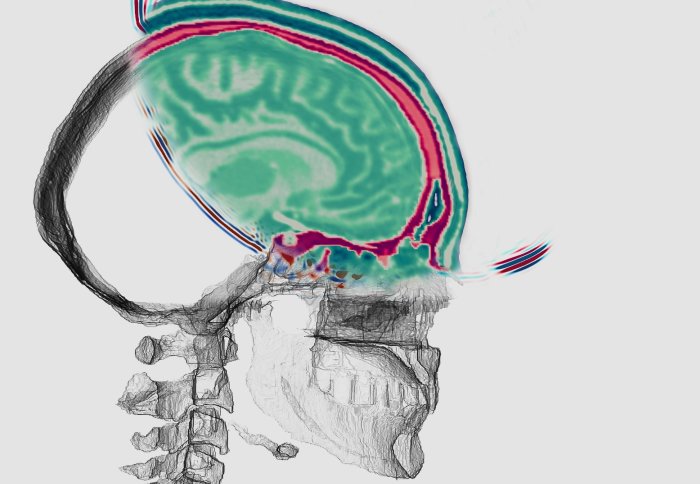 Image of what the brain reconstruction could look like inside a skull