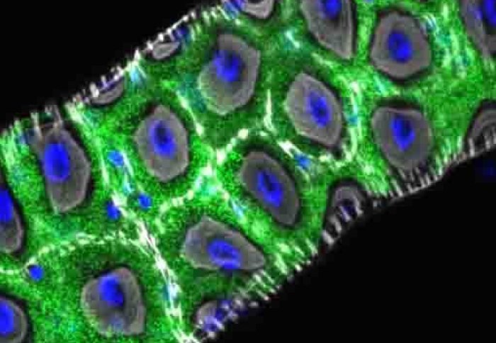 image shows the segment of the Drosophila intestine where the Hodor zinc sensor is found.