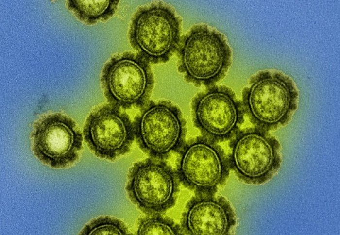 Microscopy image of H1N1 influenza