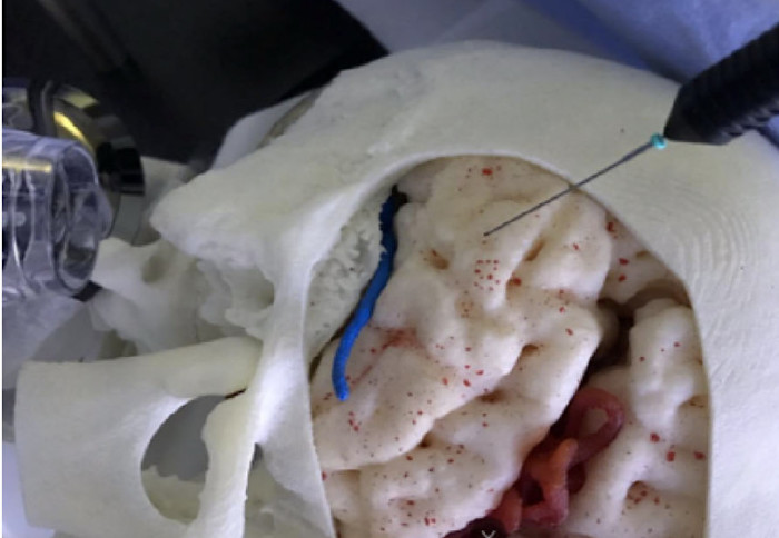 Automatic Microsurgical Skill Assessment Based on Cross-Domain Transfer Learning