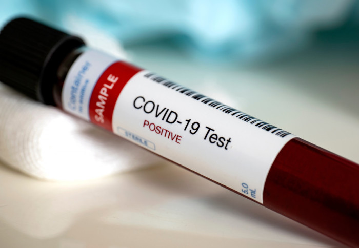 A vial of blood with a label reading 'COVID-19 testing'