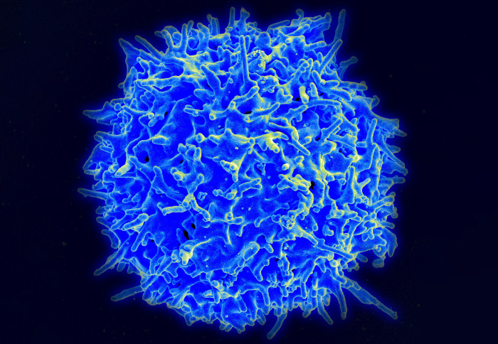 Scanning electron micrograph of a human T lymphocyte (also called a T cell) from the immune system of a healthy donor.