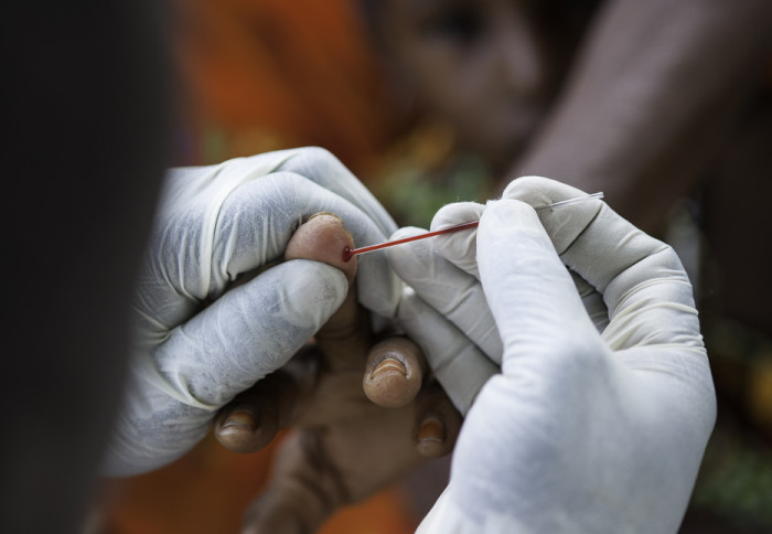 Doctor taking a blood sample from a patient's finger