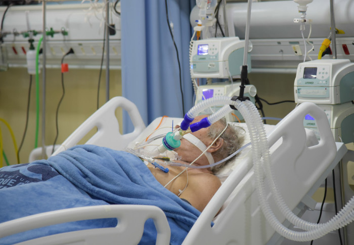 Man on ICU ventilator