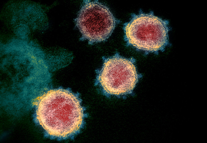 The SARS-CoV-2 coronavirus imaged under a microscope
