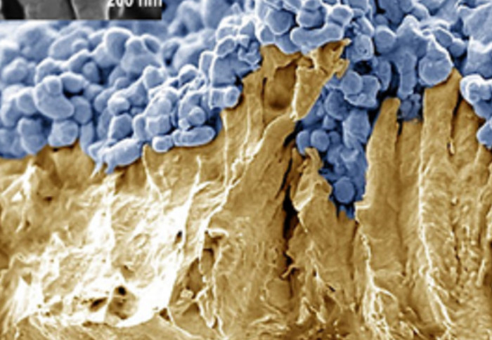 An electron microscope image of the photocatalyst sheets used in the study. The La,Rh:SrTiO3 particles (blue) on a support metal (here for this study made of gold).