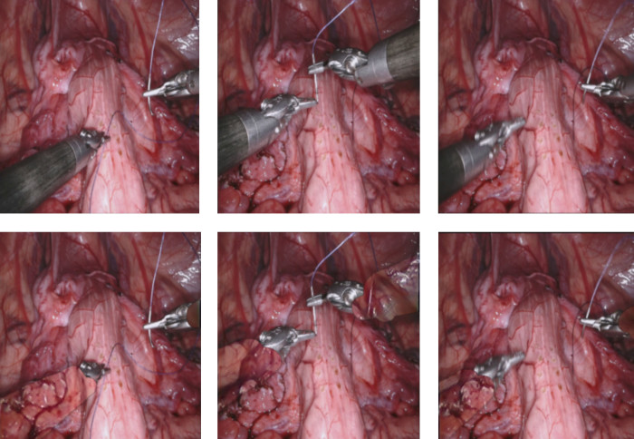 See-Through Vision with Unsupervised Scene Occlusion Reconstruction