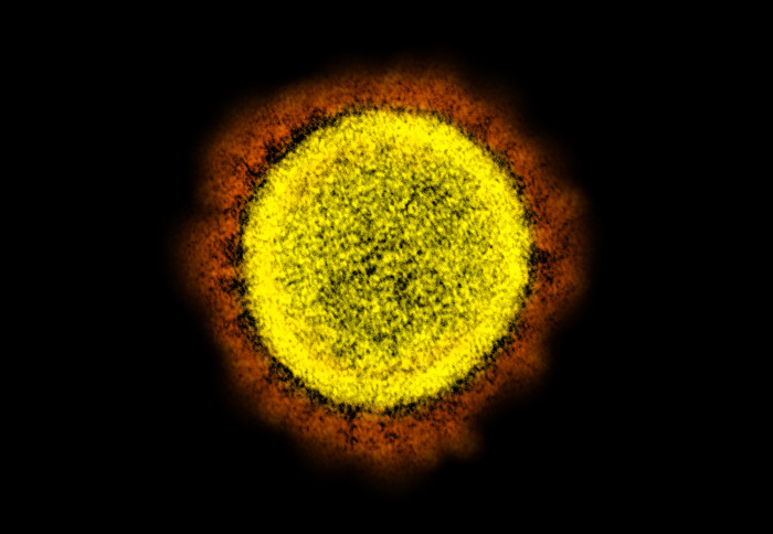 SARS-CoV-2 virus under electron microscope