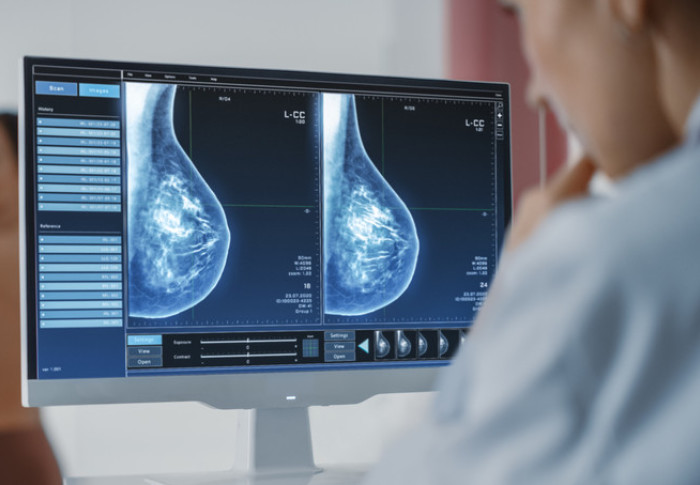 Mammography