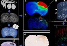 Brain injury computer models map brain blood vessels in highest resolution yet 