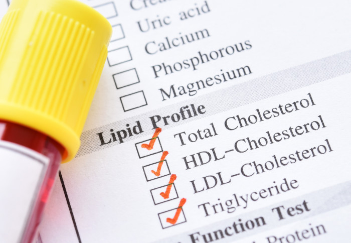 A cholesterol test