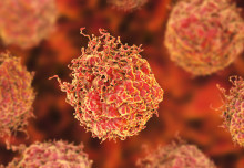  Researchers awarded £1m to trial quicker diagnostic tools for prostate cancer 