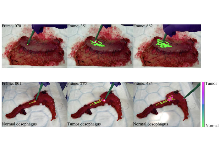 Real-time tracking of a diffuse reflectance spectroscopy probe used to aid histological validation of margin assessment in upper gastrointestinal cancer resection surgery