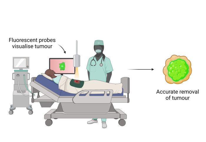 Fluorescence-guided probe