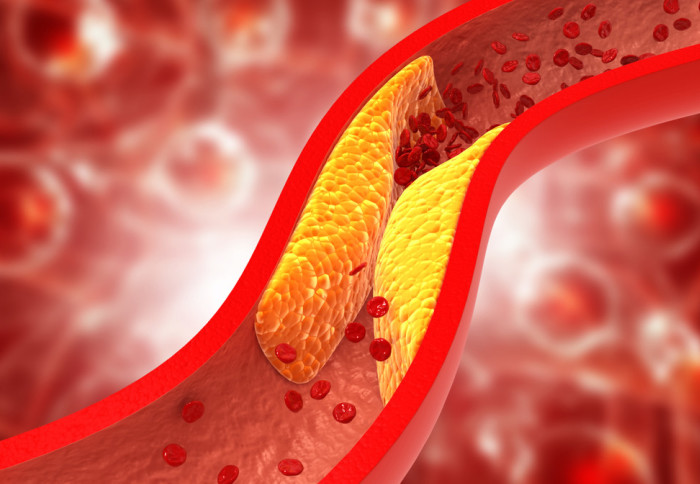 visual of cholesterol