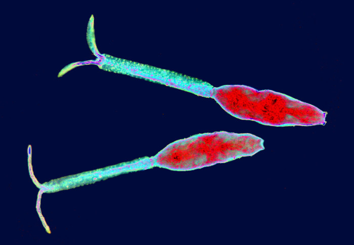 Colour-enhanced image of schistosoma cercariae, the larval form of the parasite that causes schistosomiasis