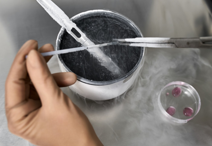 Expert in brown latex gloves takes material from the cryogenic storage during the in vitro fertilization process in the IVF lab.