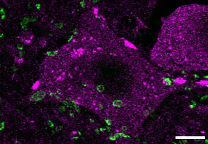 Shown is an increased density of synapses (green) that contact motoneurons (purple) in the spinal cord of an injured animal after treatment with the small molecule TTK21