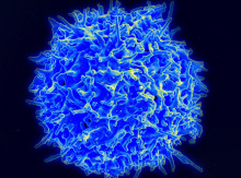 HTLV-1 targets T cells (pictured), a type of white blood cell / Credit: NIAID