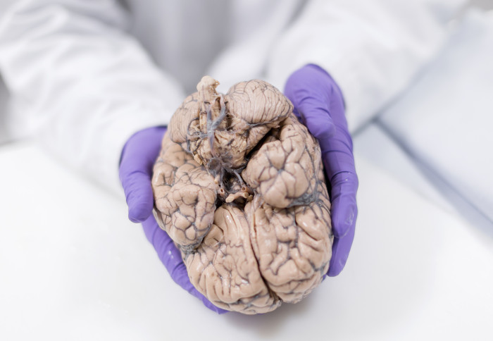 A researcher with gloved hands holds a brain