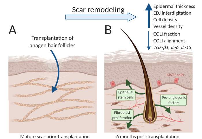 Schematic of results showing how the transplants promoted scar rejuvenation. Before and after diagrams.