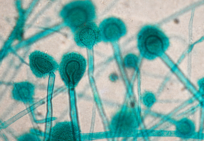 Aspergillus spores under the microscope