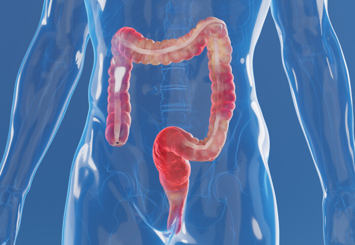 visualisation of inflamed colon