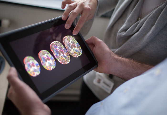 researchers examone brain scans on a tablet