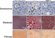 Unraveling the Secrets of Zombie cells