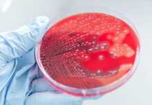 Global research network to combat deadly Strep A infections 